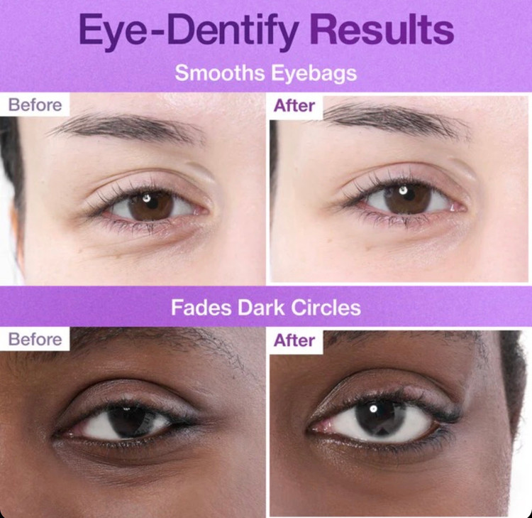 پچ زیر چشم NAD و کلاژن نامبوزین No.9 NAD+ Collagen Under Eye Patches