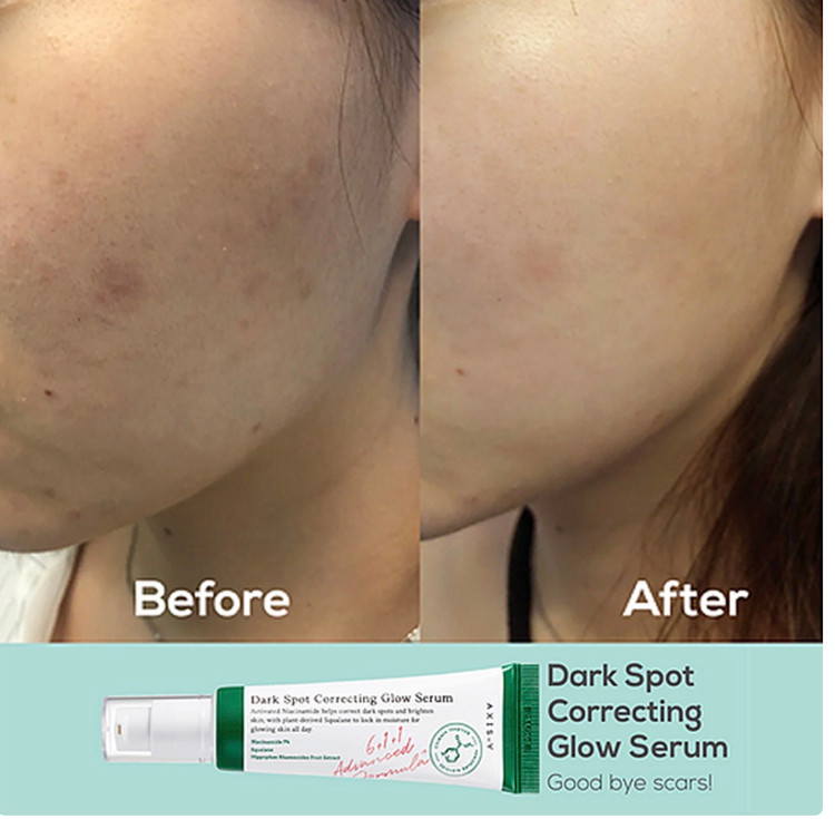 سرم ضد لک اکسیس وای مدل Dark Spot حجم 50 میلی لیتر