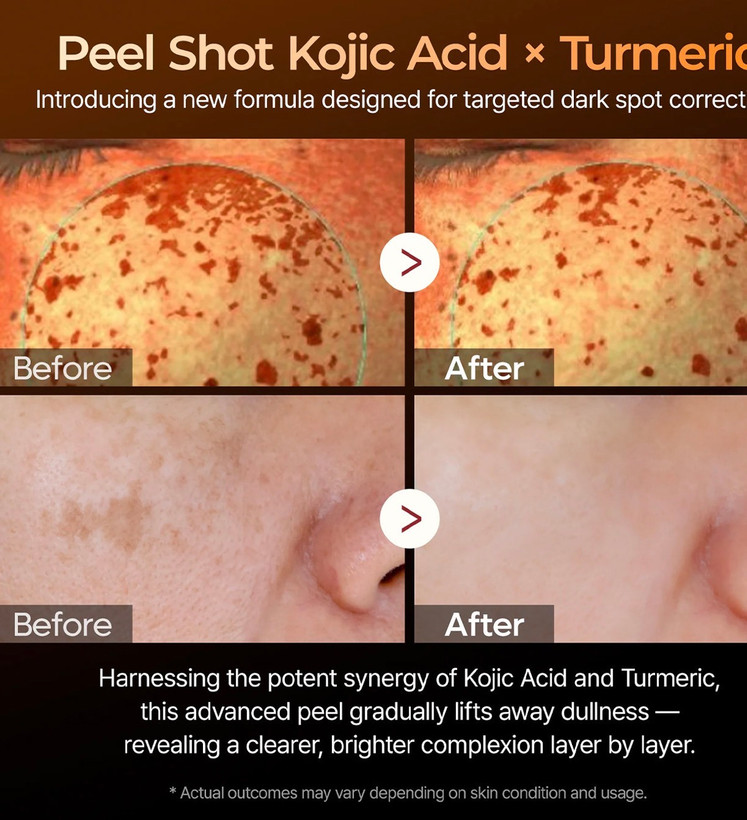 سرم لایه بردار کوجیک اسید دکتر ملاکسین مدل Peel Shot
